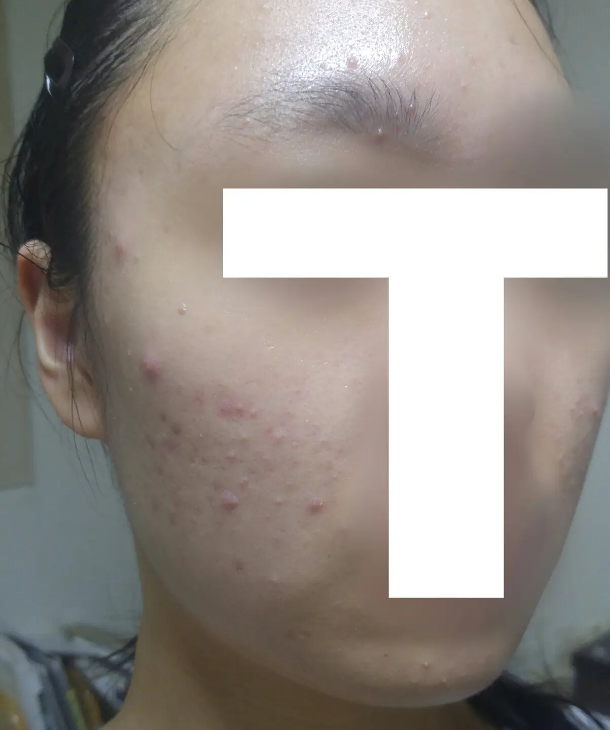선택된 언니의파우치 리뷰 이미지 - [시칼파트 SOS 크림]