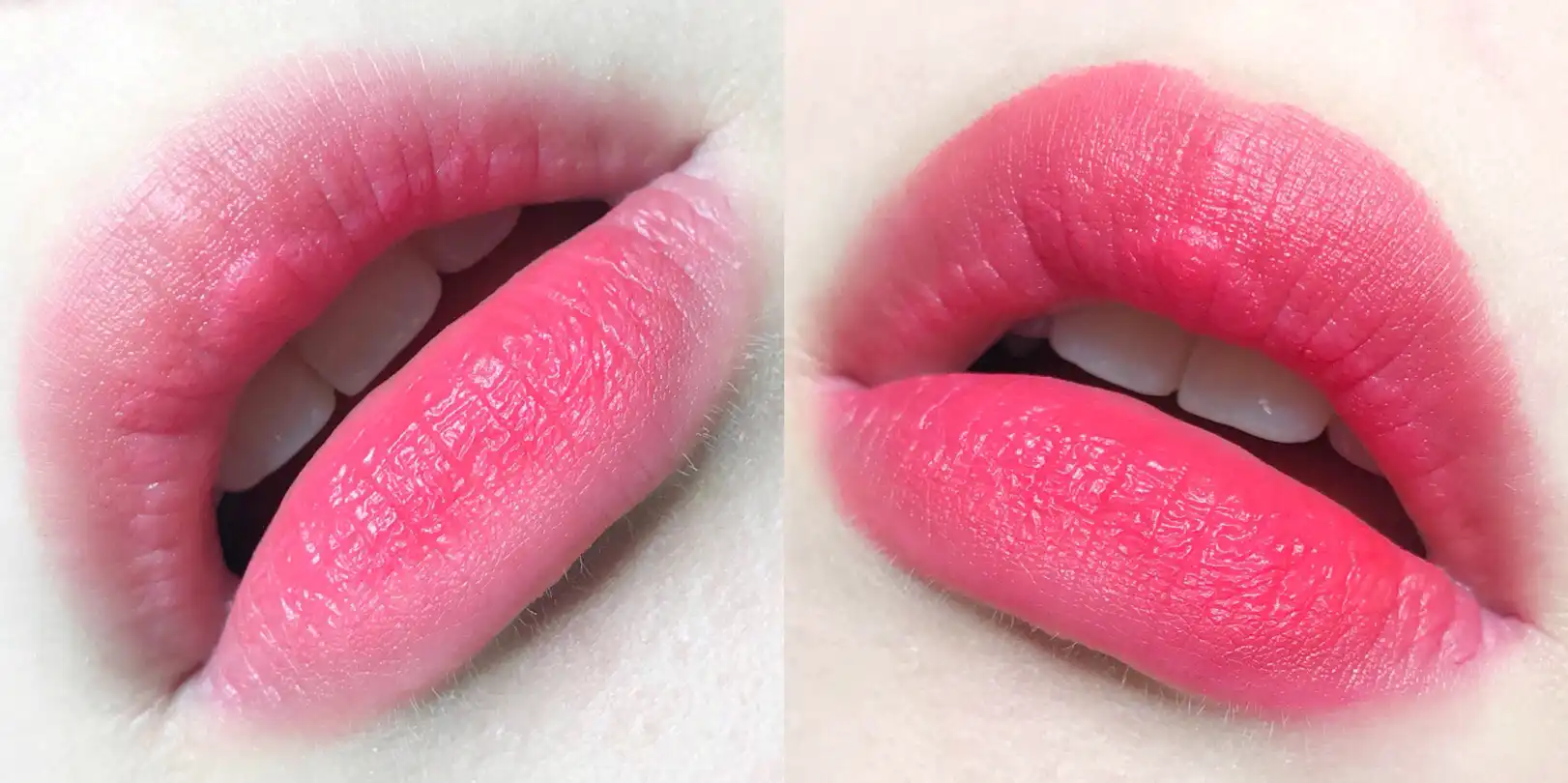 다이노플라츠 바치오브라키오 [no1 돌체]