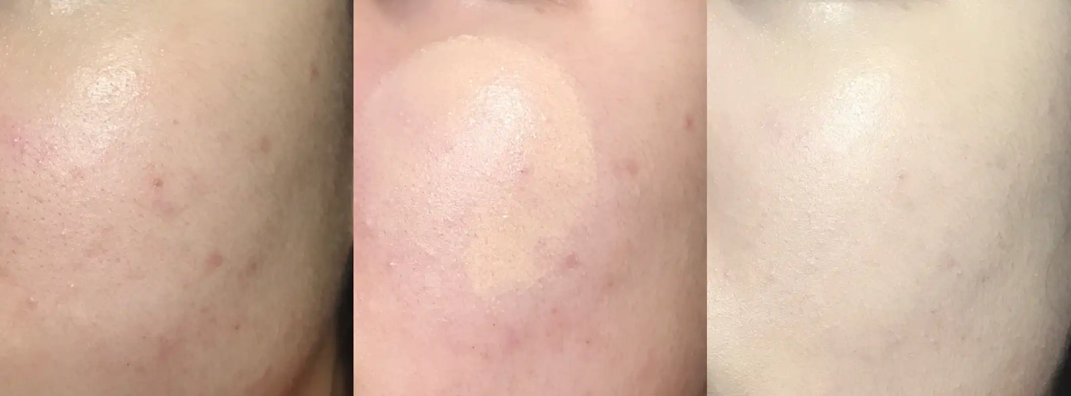 킬커버 파운웨어 쿠션 엑스피 [003 리넨]