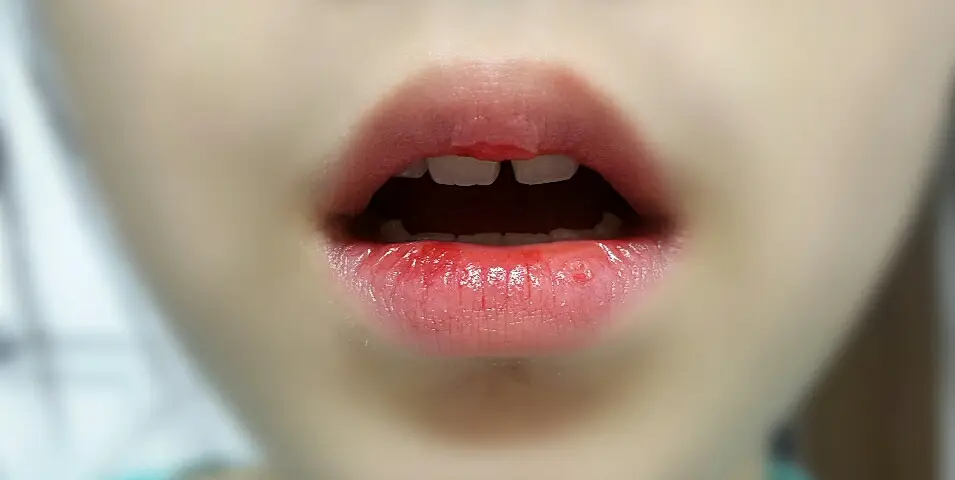 선택된 언니의파우치 리뷰 이미지 - [컬러 래스팅 틴트 02호 베이비윙크]