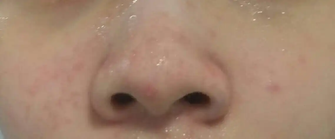 언니의파우치 리뷰 이미지 5 - [탈스 블루 캐모마일 울트라 카밍 젤 ]