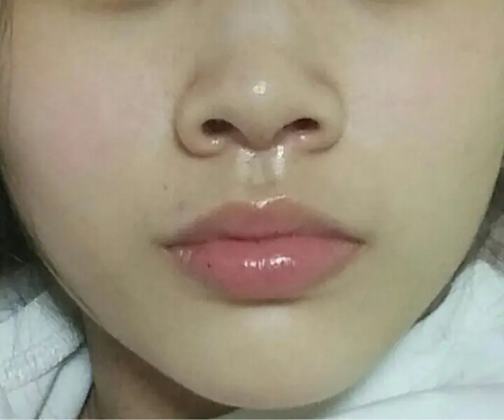선택된 언니의파우치 리뷰 이미지 - [순정 약산성 5.5 진정 토너]