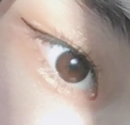 언니의파우치 리뷰 이미지 10 - [쇼킹아이글루(성형팬)]