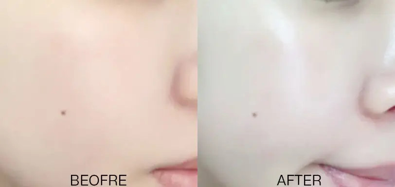 선택된 언니의파우치 리뷰 이미지 - [안티박 더마 라이트 선젤]