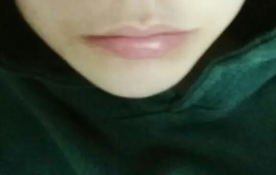 선택된 언니의파우치 리뷰 이미지 - [멜팅 립밤 - 각질 케어]