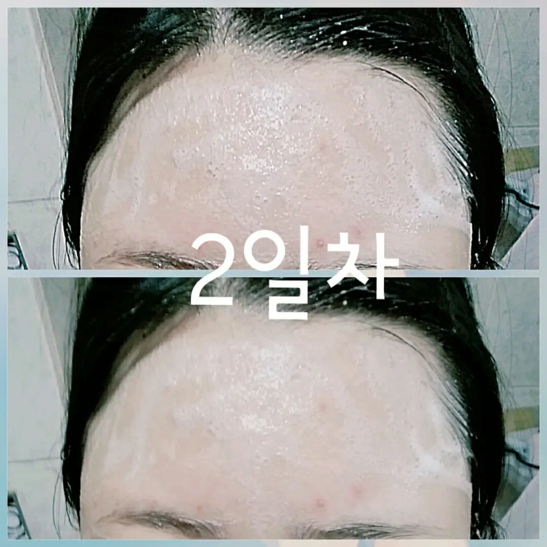 선택된 언니의파우치 리뷰 이미지 - [언파 핌플브릭]