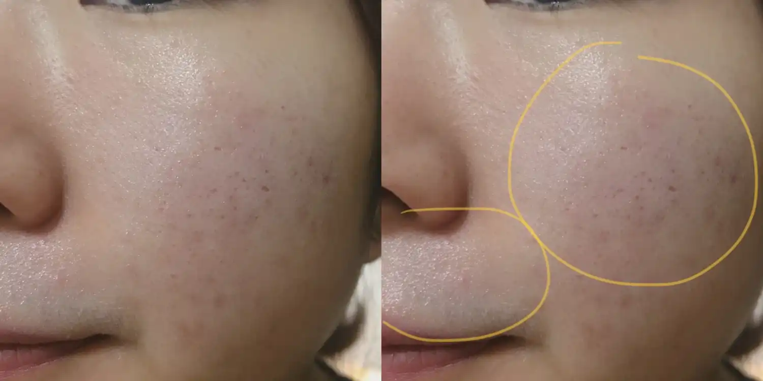 언니의파우치 리뷰 이미지 8 - [아토 수딩 선 스틱]