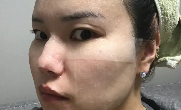 히알론 모이스트 액티브 씰 마스크