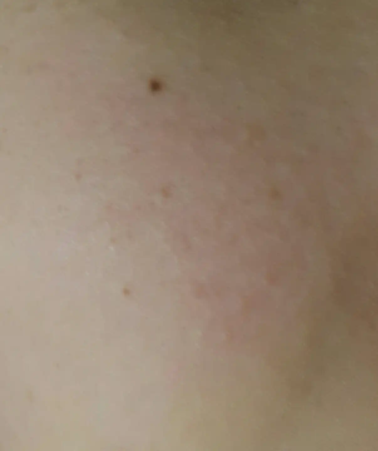 언니의파우치 리뷰 이미지 8 - [골드 스팀 랩 마스크]