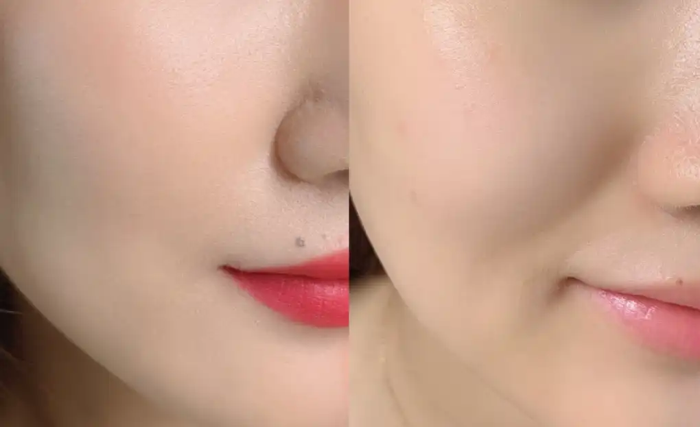 힐링 티 가든 클렌징 코튼 패드