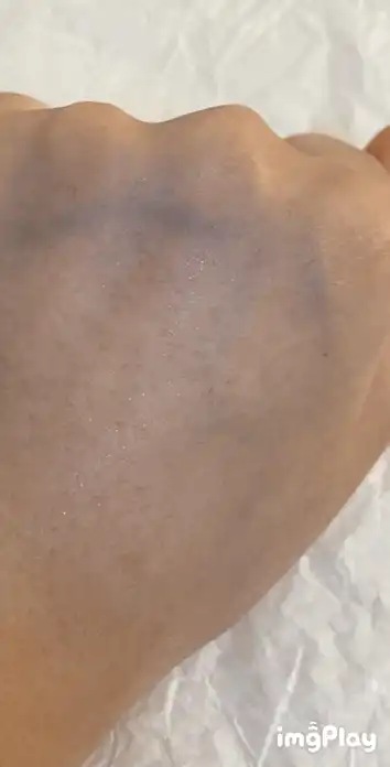 언니의파우치 리뷰 이미지 11 - [어니언 뉴페어 클리어 패드]