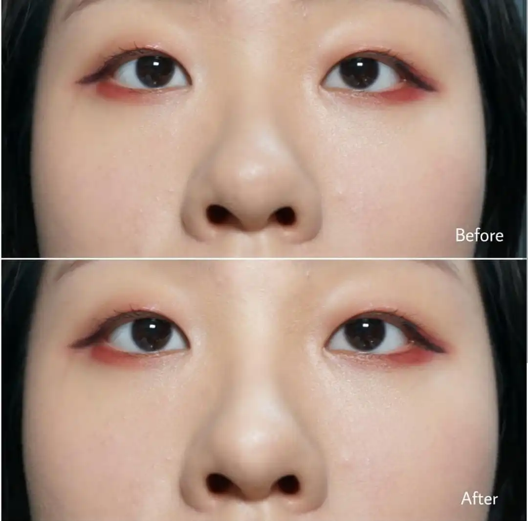 언니의파우치 리뷰 이미지 8 - [16 필터 샷 - 컨투어피치]