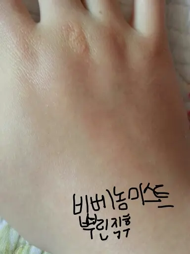 선택된 언니의파우치 리뷰 이미지 - [비베놈 미스트 에센스]