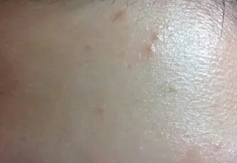 선택된 언니의파우치 리뷰 이미지 - [난코 티트리 스틱]