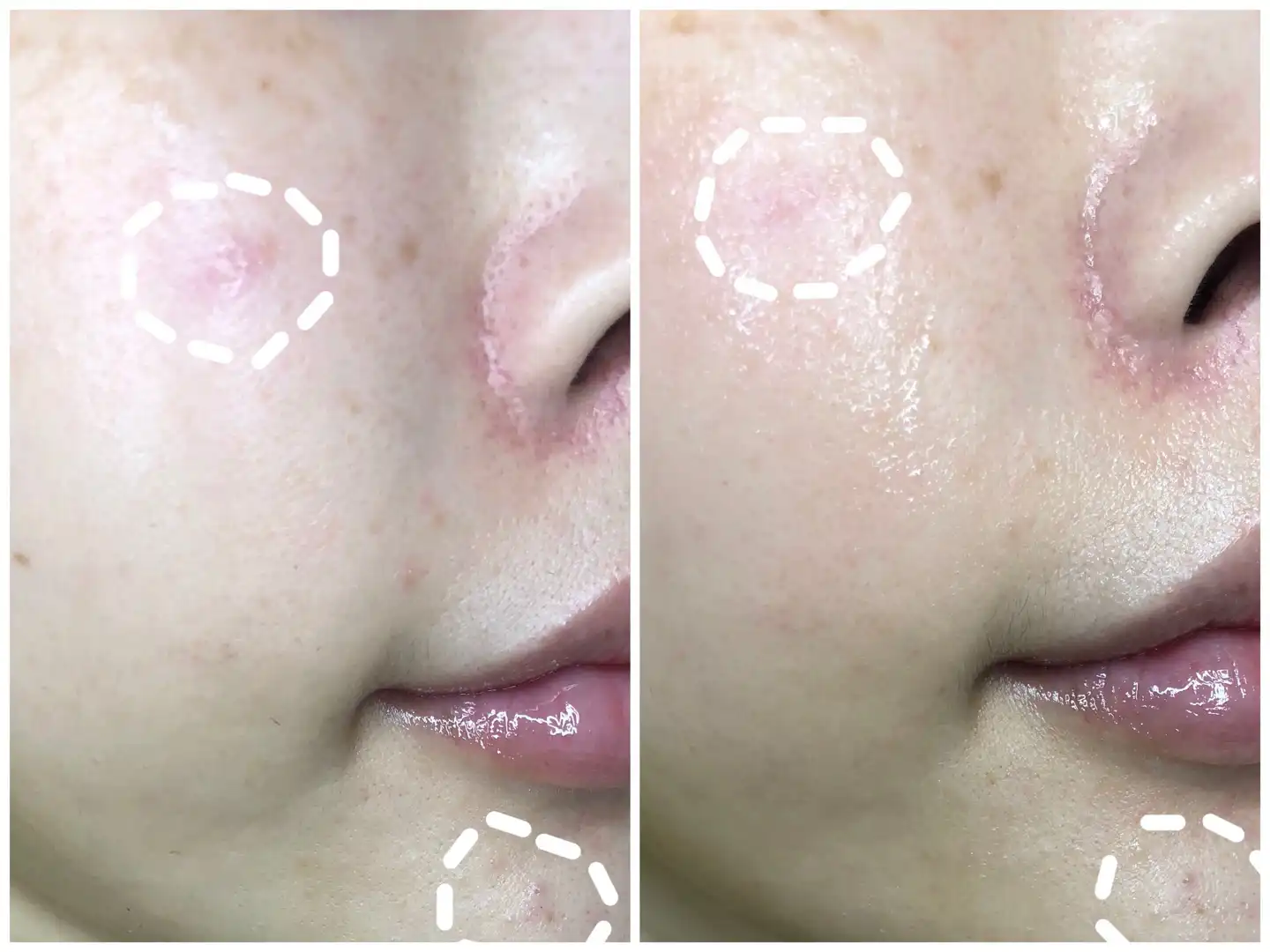 언니의파우치 리뷰 이미지 4 - [100 콜라겐 퓨어 에센스 마스크팩]