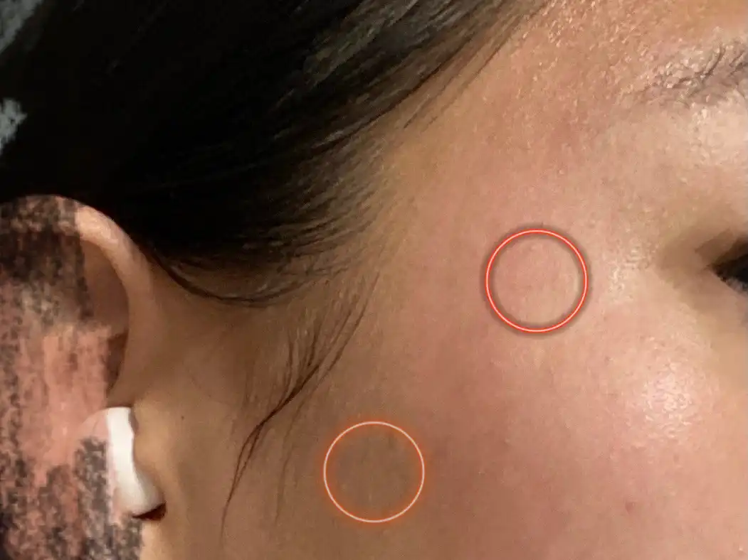 아임 더 미라클 피오나 핑크팩