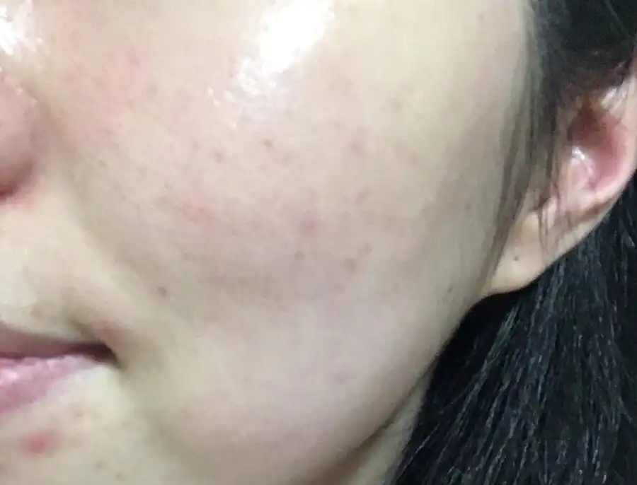언니의파우치 리뷰 이미지 2 - [퓨어 카밍 시카 크림]