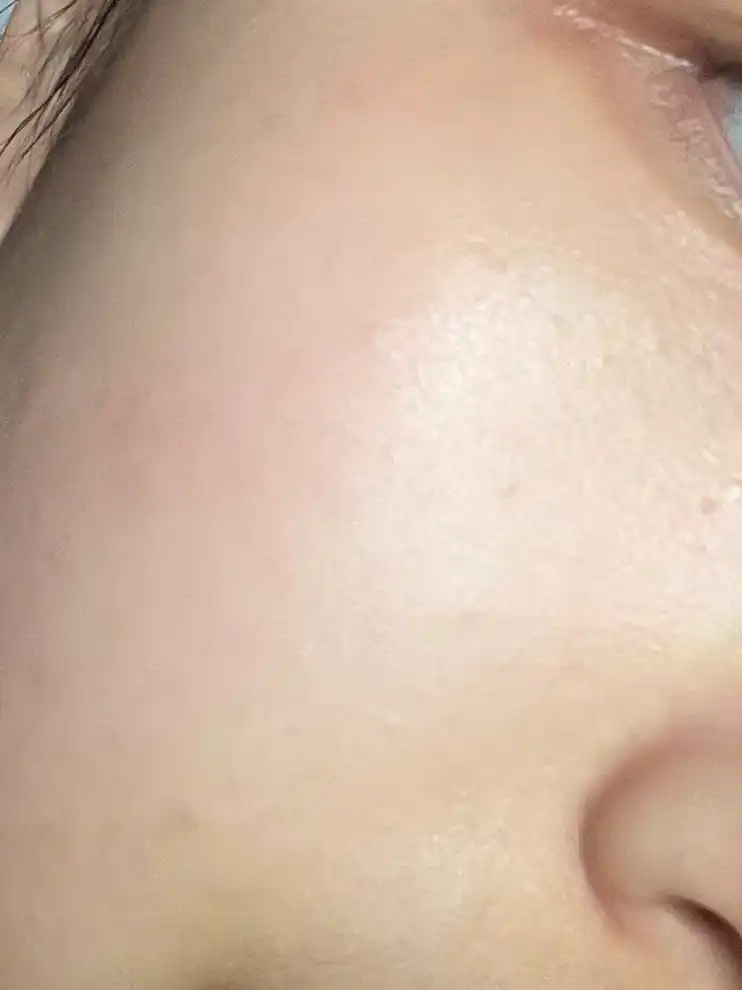 언니의파우치 리뷰 이미지 7 - [세이프 미 릴리프 베리어 크림]