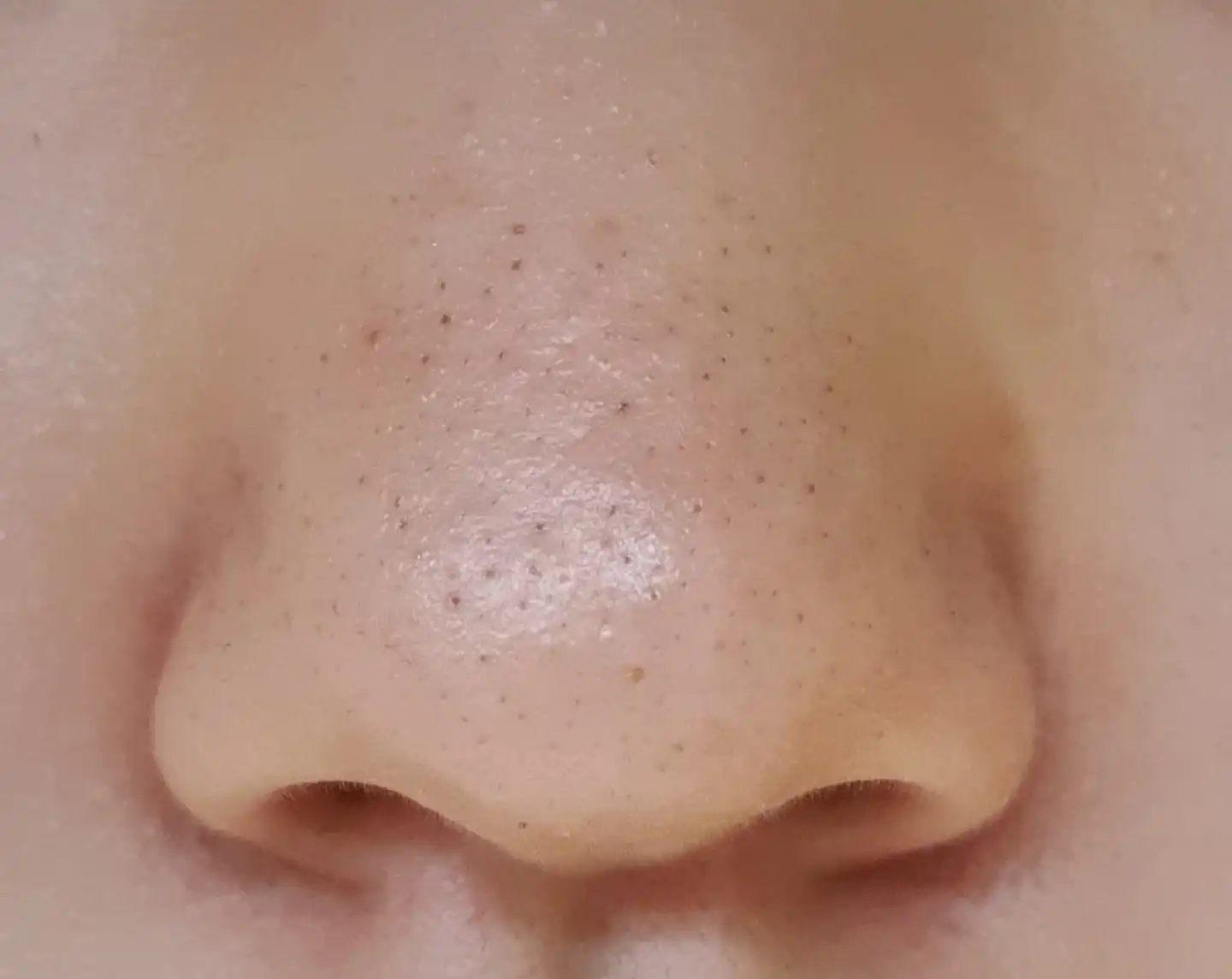 언니의파우치 리뷰 이미지 7 - [안티 포어 블랙헤드 클리어 키트]