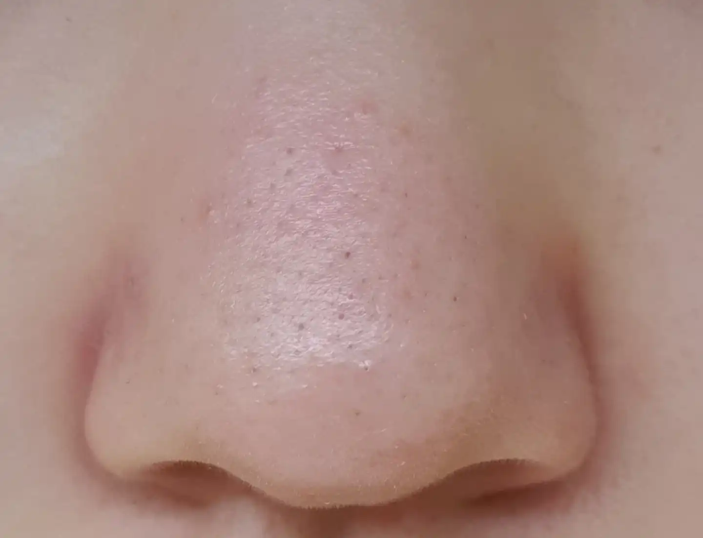언니의파우치 리뷰 이미지 10 - [안티 포어 블랙헤드 클리어 키트]