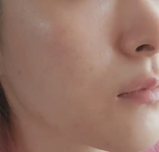 언니의파우치 리뷰 이미지 4 - [산뽕나무 잡티 앰플]