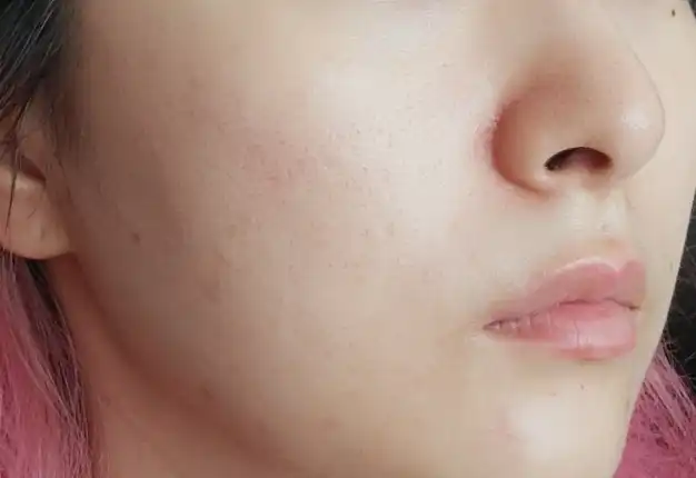 언니의파우치 리뷰 이미지 5 - [산뽕나무 잡티 앰플]