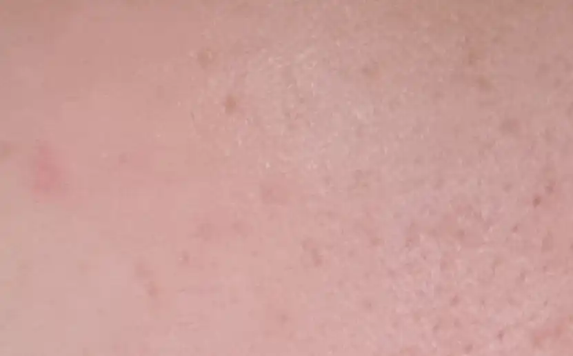 에코 어스 파워 핑크 선 스틱