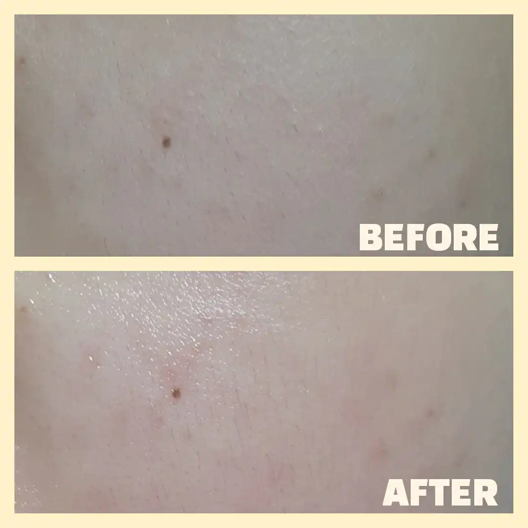 스팟 이레이저 비타 마스크