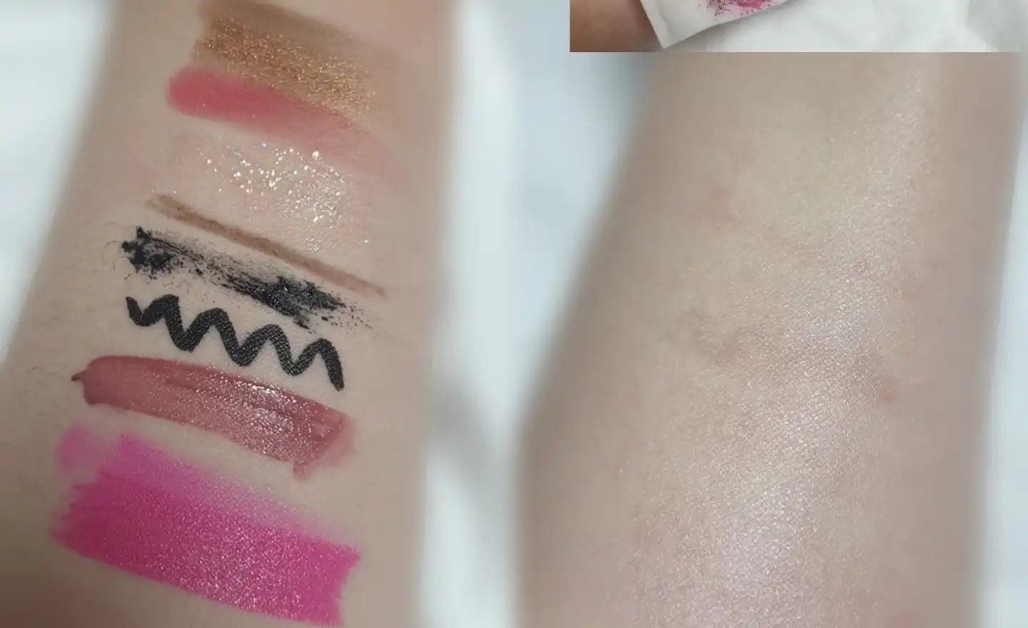 립 앤 아이 리무버