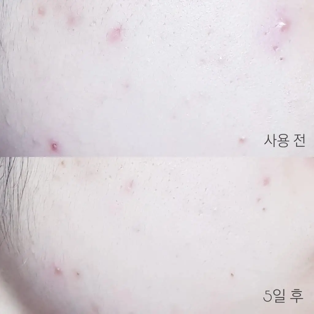 선택된 언니의파우치 리뷰 이미지 - [ 해풍쑥 에센스]