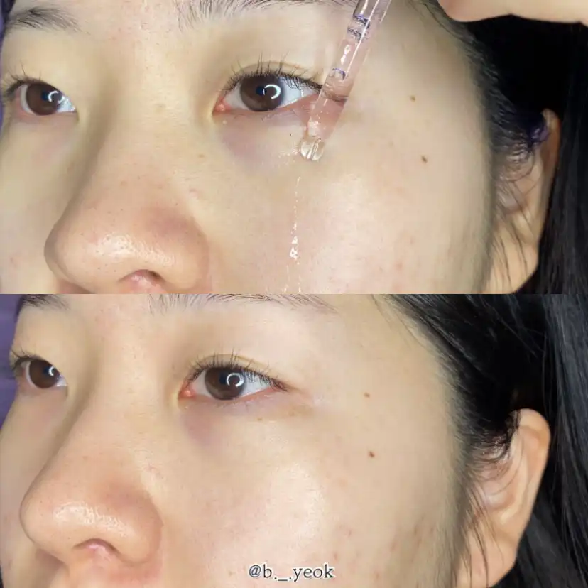 언니의파우치 리뷰 이미지 6 - [언파 할로 셀트닝 앰플]