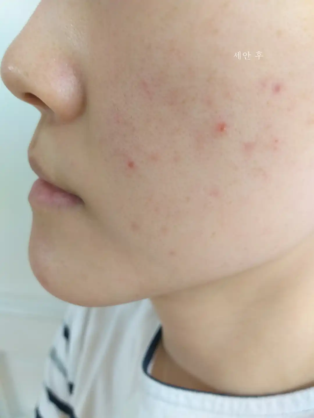 언니의파우치 리뷰 이미지 9 - [수퍼 아쿠아 울트라 히알론 크림]