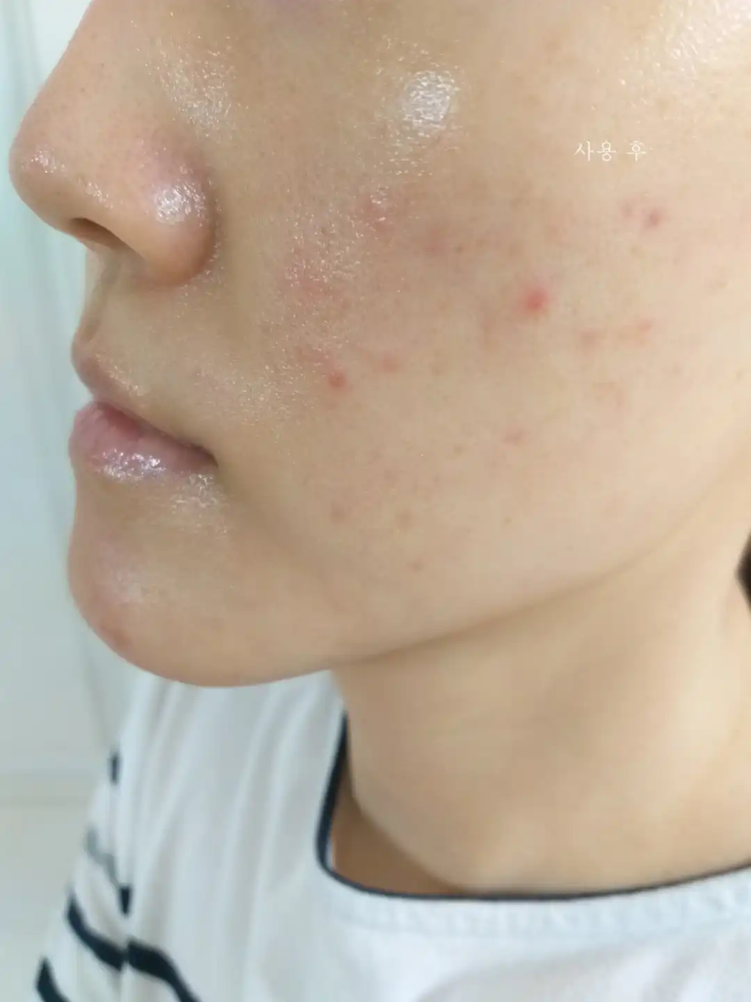 언니의파우치 리뷰 이미지 10 - [수퍼 아쿠아 울트라 히알론 크림]