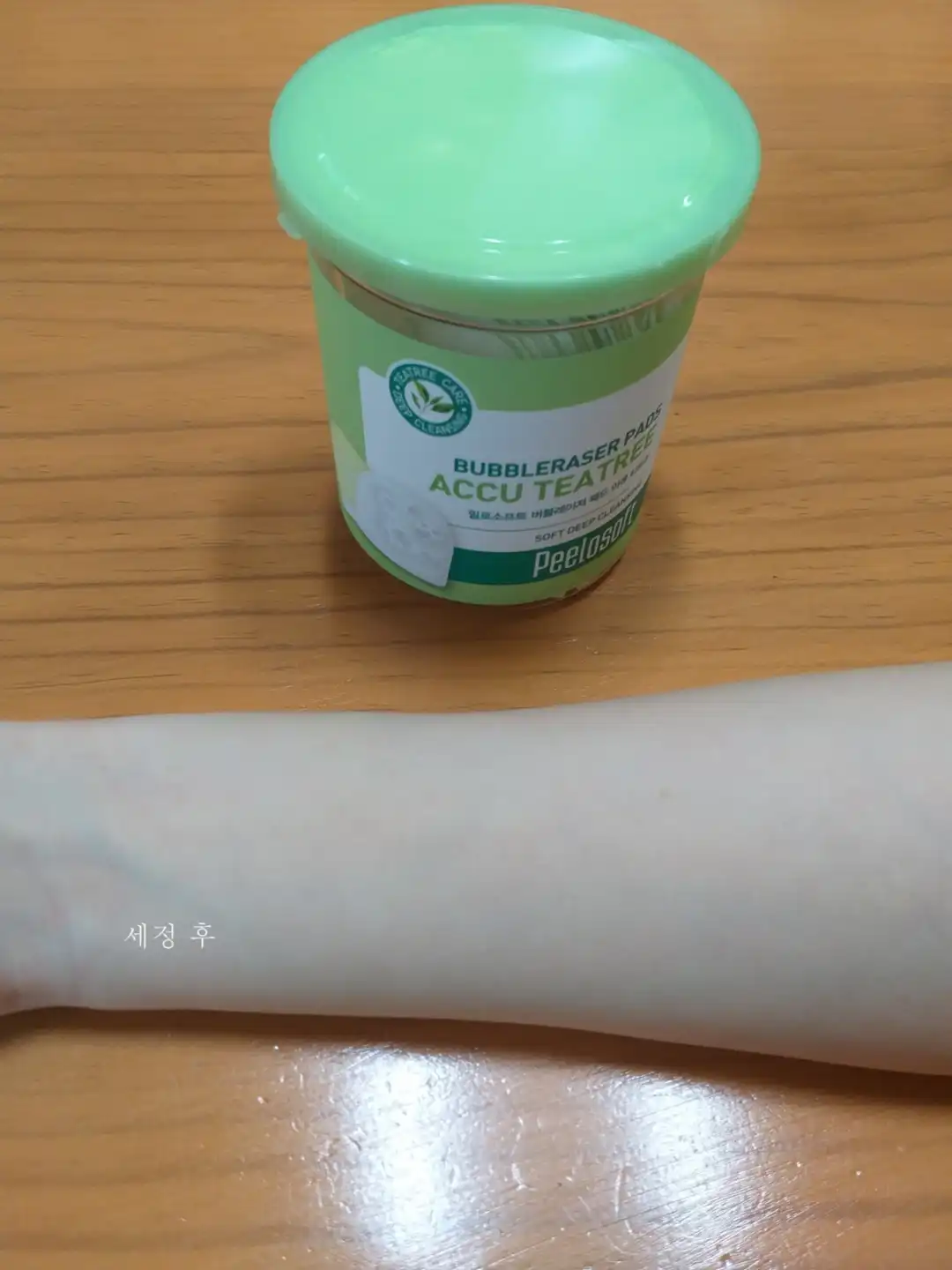 언니의파우치 리뷰 이미지 7 - [필로소프트 버블레이저 패드 아큐티트리]