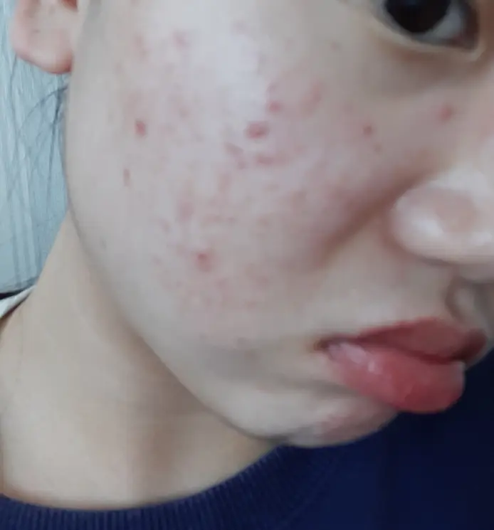 선택된 언니의파우치 리뷰 이미지 - [세라마이드 아토 집중 크림]