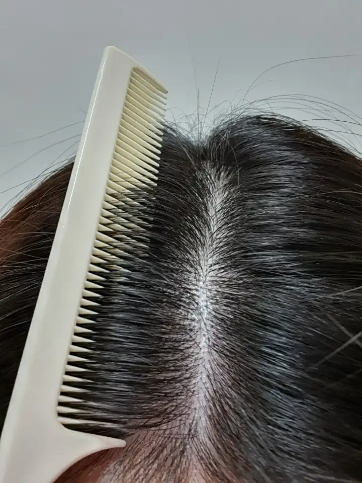 언니의파우치 리뷰 이미지 6 - [데일리 안티 헤어로스 허브 헤어토닉]