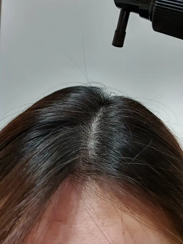 언니의파우치 리뷰 이미지 7 - [데일리 안티 헤어로스 허브 헤어토닉]