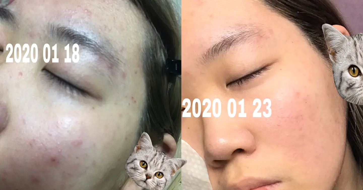 선택된 언니의파우치 리뷰 이미지 - [청귤 비타C 토너패드]