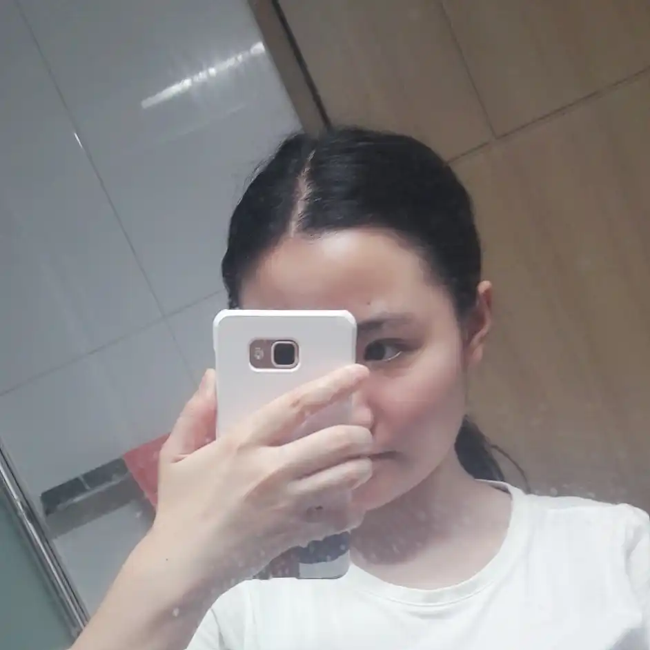 언니의파우치 리뷰 이미지 4 - [마일드 AC 릴리프 클렌저]