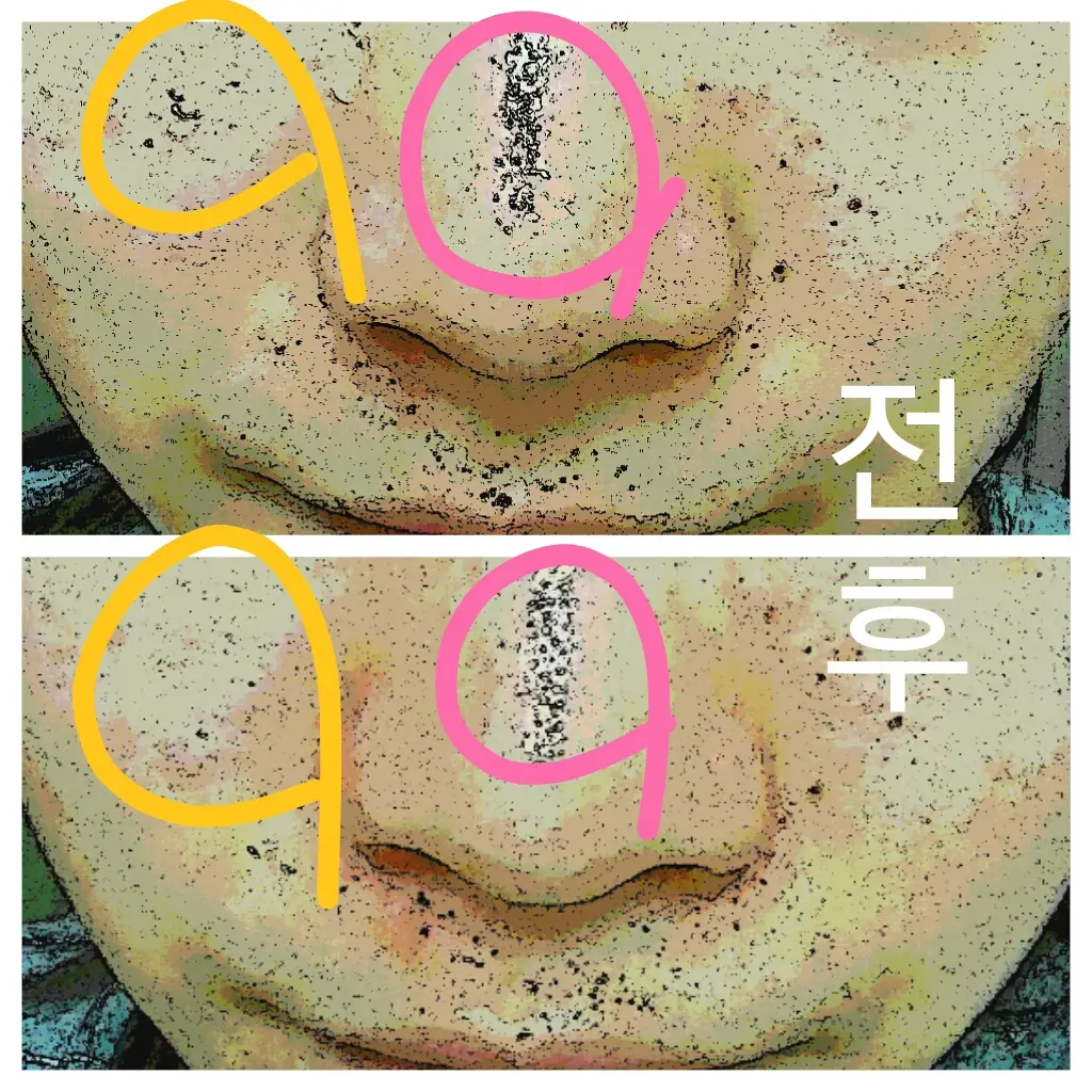 선택된 언니의파우치 리뷰 이미지 - [어성초 포어 클린 블랙헤드 스틱]