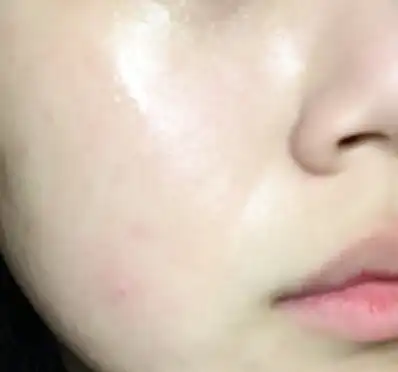 언니의파우치 리뷰 이미지 10 - [유니베라 스킨케어100]