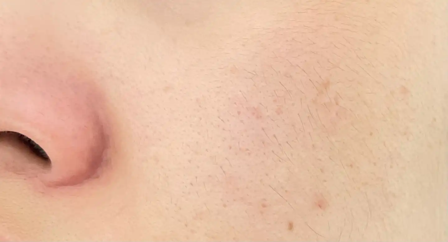 언니의파우치 리뷰 이미지 9 - [비타씨플러스 잡티씨 탄력앰플]