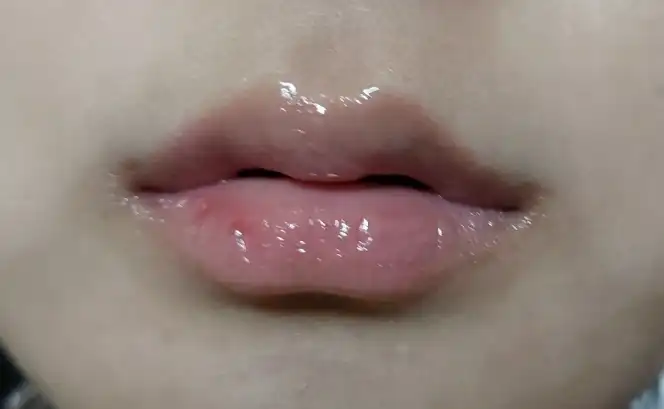 부비부비 립 앰플