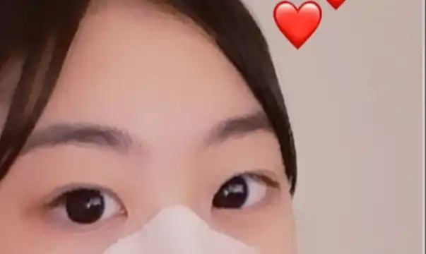 피부고민 지우개 코팩 