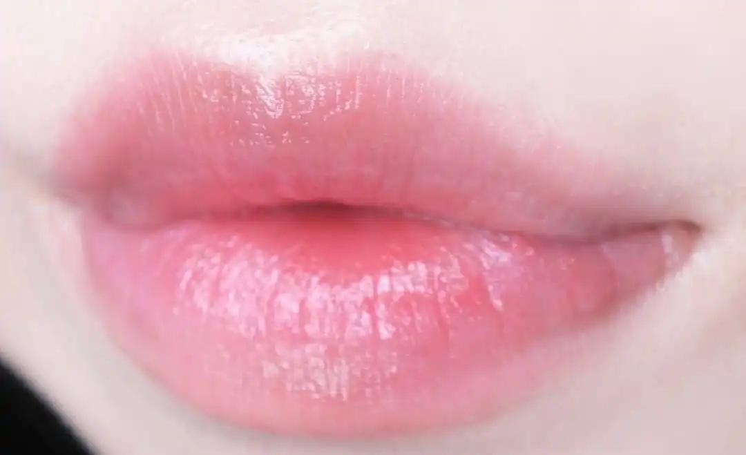 립 글로리파이어 [레드]