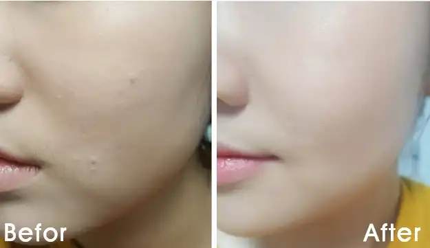 언니의파우치 리뷰 이미지 5 - [언파 부비부비 페이스]