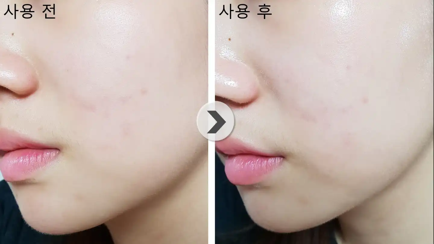 언니의파우치 리뷰 이미지 8 - [비폴렌 리뉴 앰풀러]