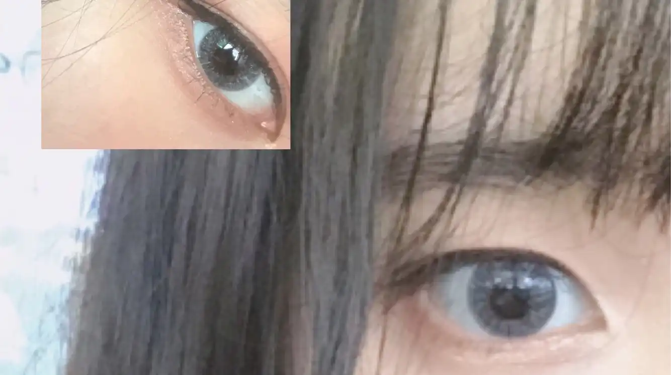 글로리 [그레이]