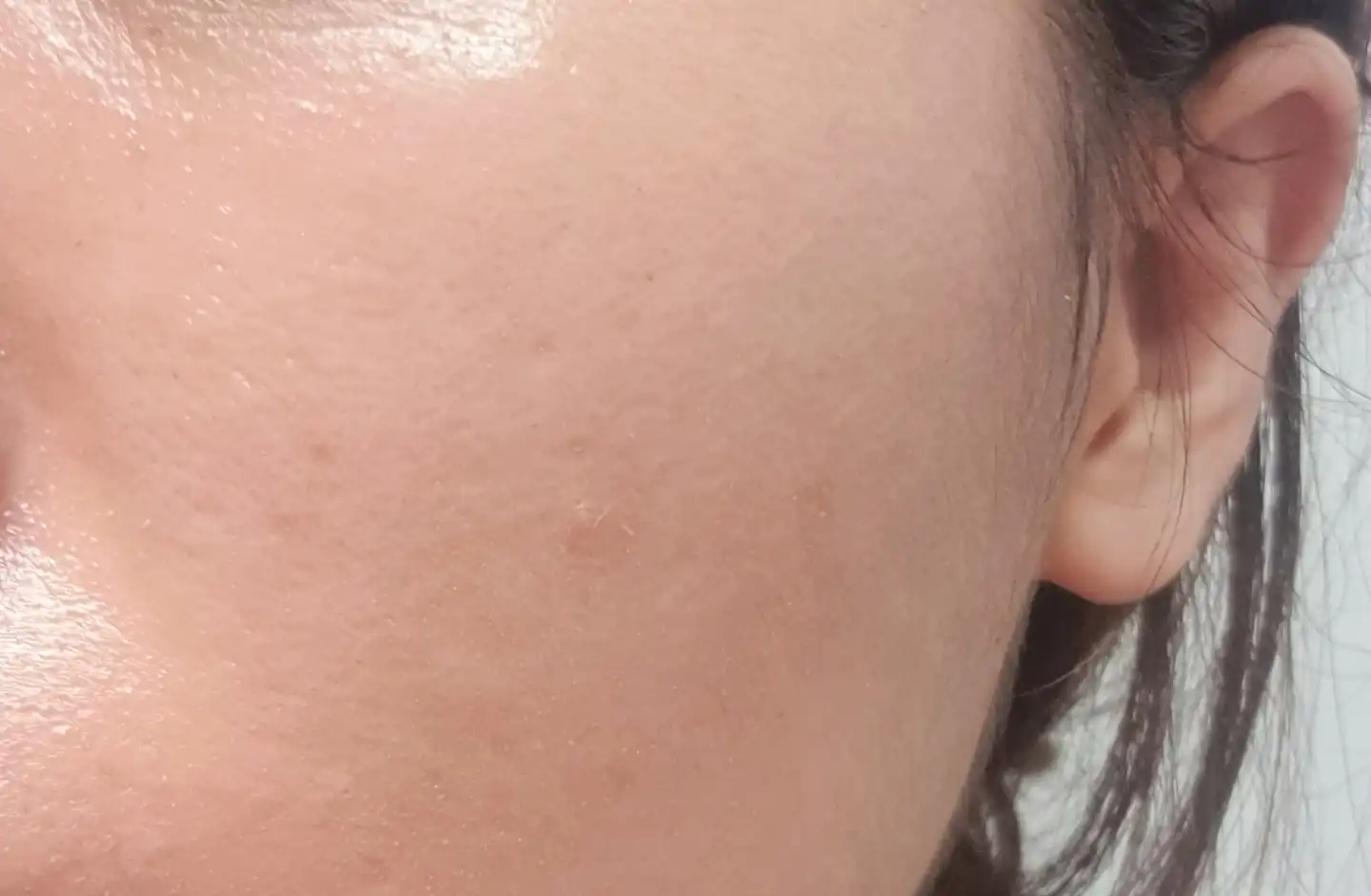 바이바이 시카 세럼