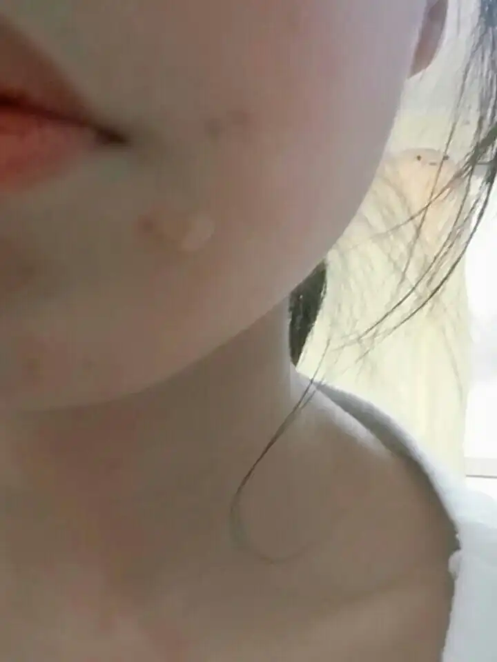 언니의파우치 리뷰 이미지 5 - [클리어페이스 스팟 컨트롤 젤]